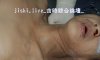 YE0619_13_国内尸检抢救无效死亡的车祸女，裸检验B 19P 高清图片