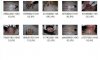YE0619_11_国内女工宿舍现场检验死去的厂妹，裸检15P 高清图片