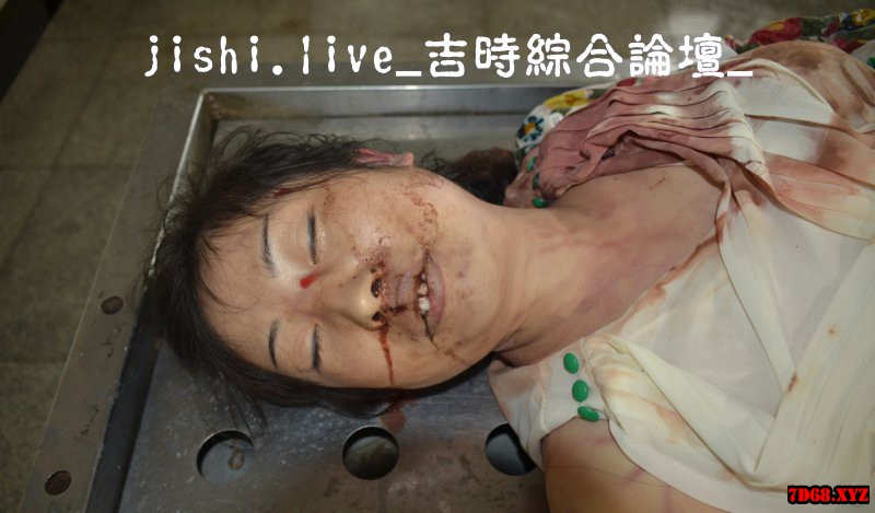 YE0619_6_国内检验死因不明的女性9P 高清图片